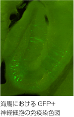 海馬におけるGFP+神経細胞の免疫染色図