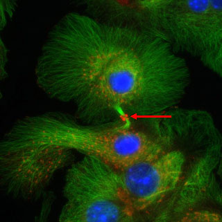正常マウスの肝細胞の初代培養における活性化Erk（pErk1／2）の発現