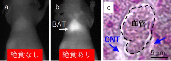 PLPEGで被覆したSWCNTを尾静脈に投与したマウスの（a、b）BAT部分のNIRF造影像と